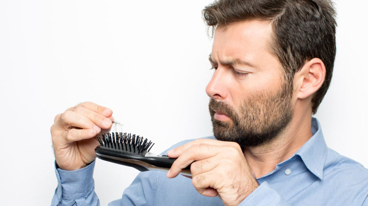Erkeklerde Saç Dökülmesi - Antalya Sakal Ekimi